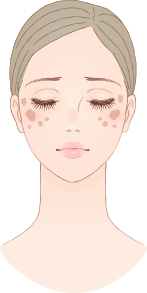 しみケアプランの画像