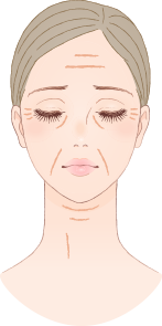 しわケアプランの画像
