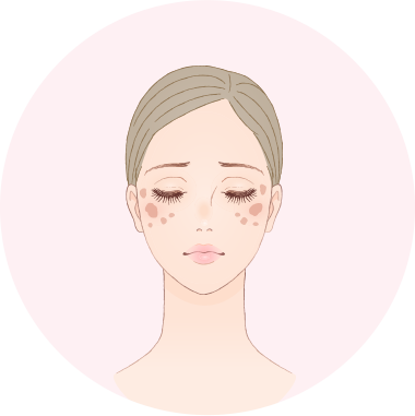 たるみケアプランの画像