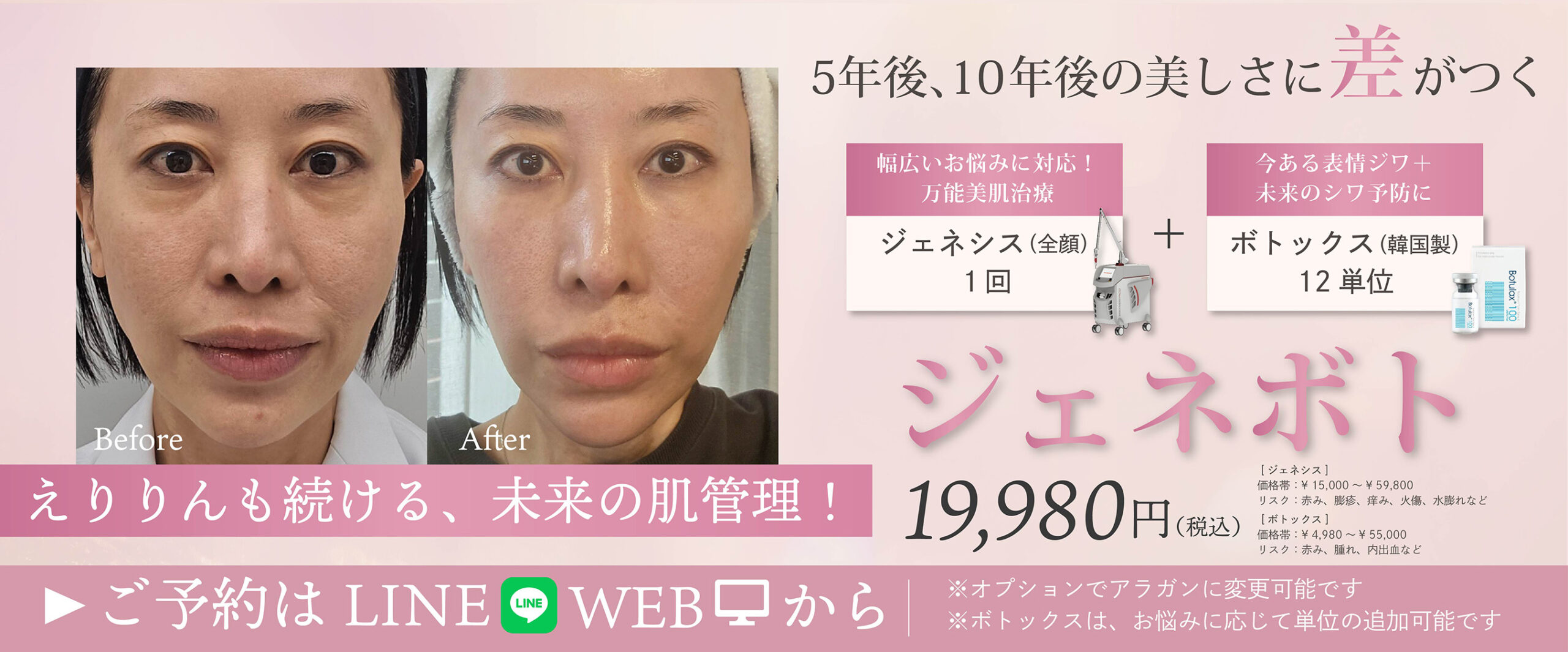 MV画像3